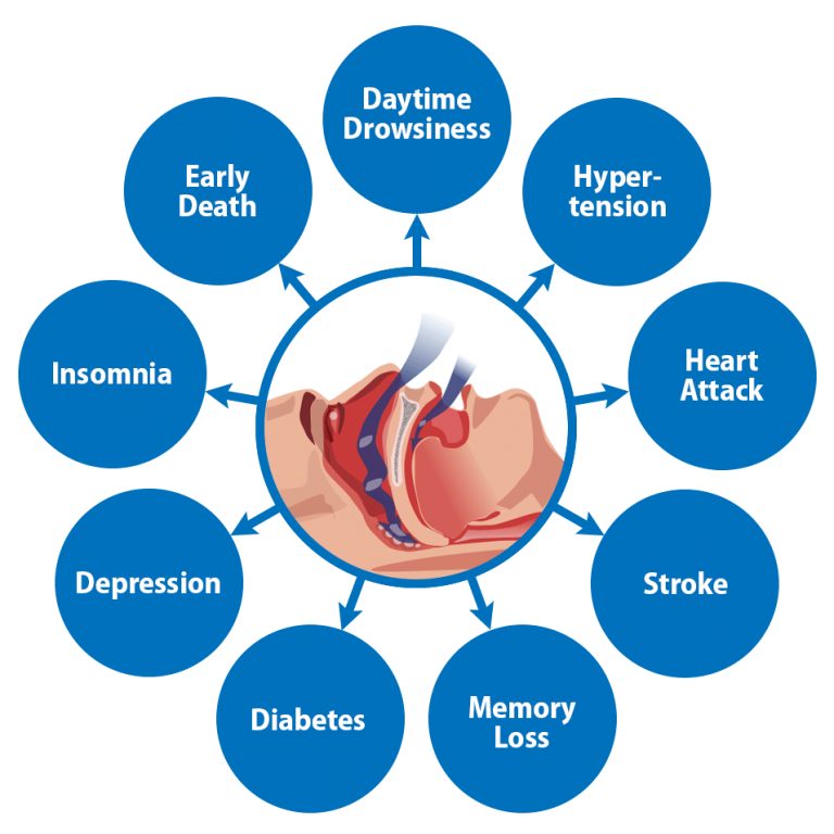 What is Sleep Apnea Therapy?